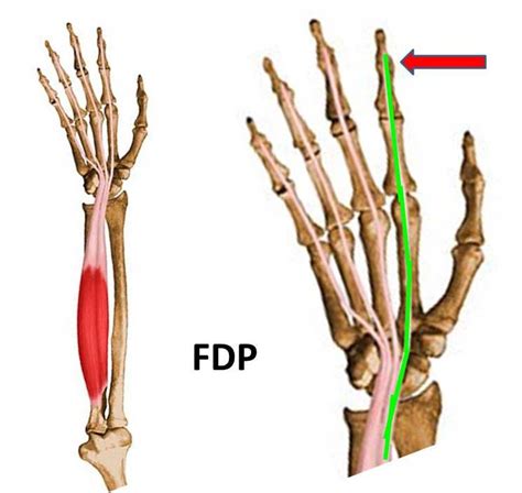 fdp muscle hand